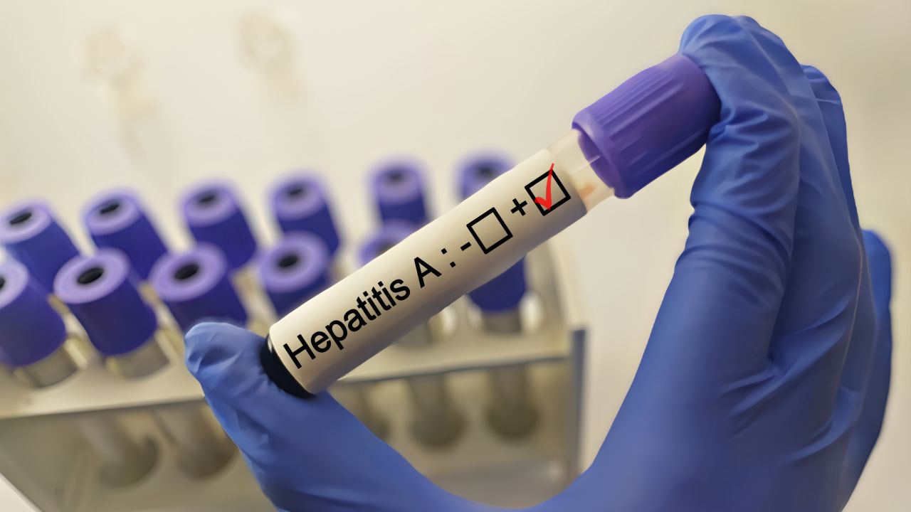 Cazuri de hepatită A în creștere în județ: Săcele, printre localitățile cu focare comunitare active