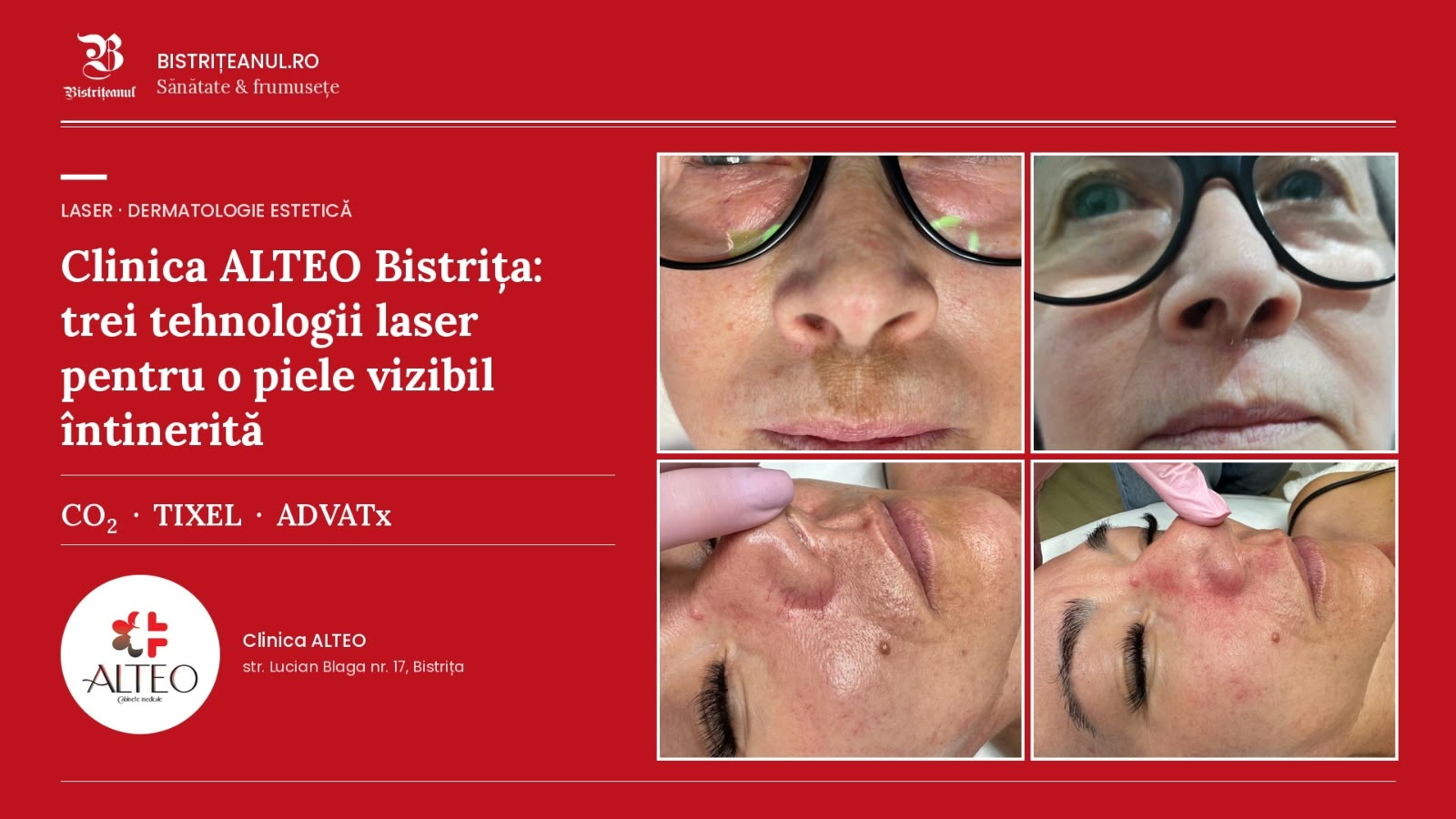 Clinica ALTEO Bistrița: Descoperă toamna aceasta tratamentele laser care îți transformă vizibil pielea!