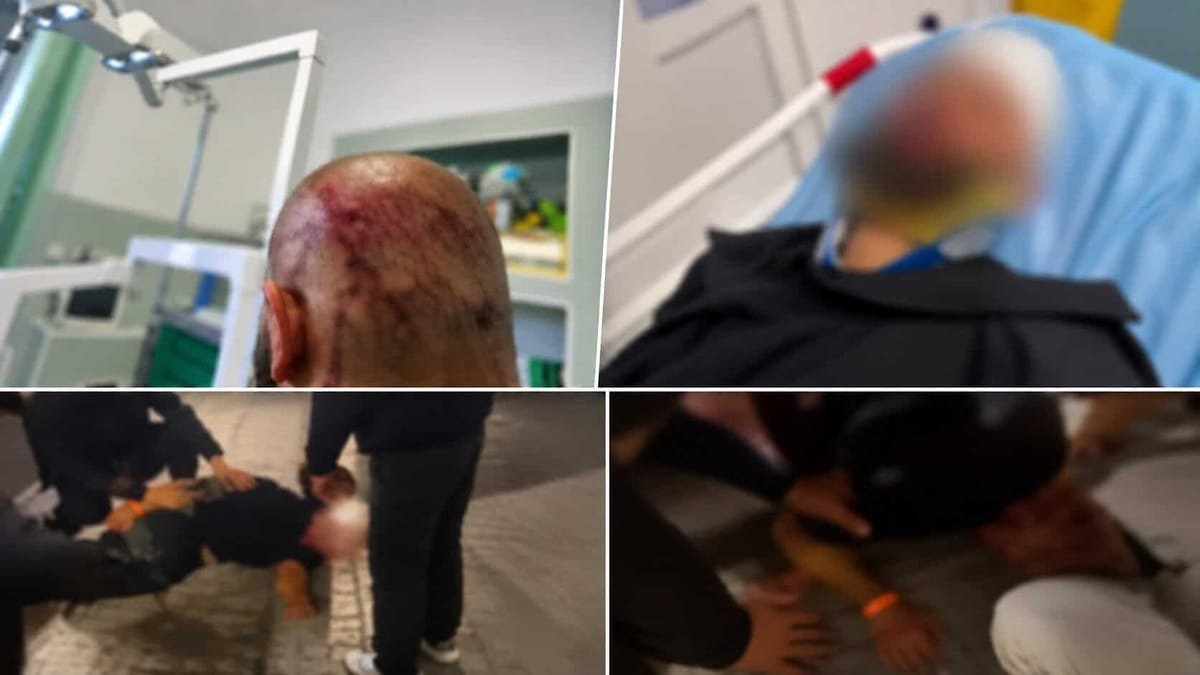 Cluj, pe strada Piezișă: tânăr bătut crunt în fața clubului Havana, după ce a căzut și s-a lovit la cap. VIDEO