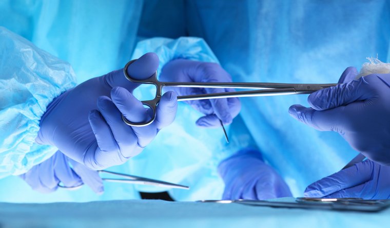 Extirparea apendicelui, asociată cu un risc mult mai mic de cancer colorectal decât antibioticele