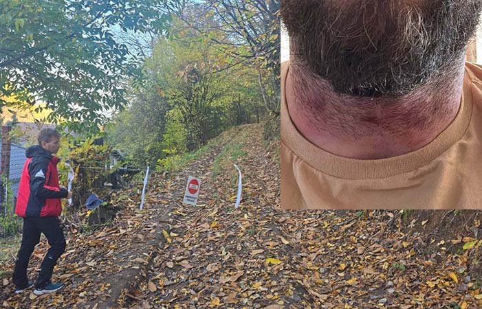 Maramureș: biciclist montan rănit pe traseul Cruce Albastră, după ce a lovit un cablu întins pe traseu