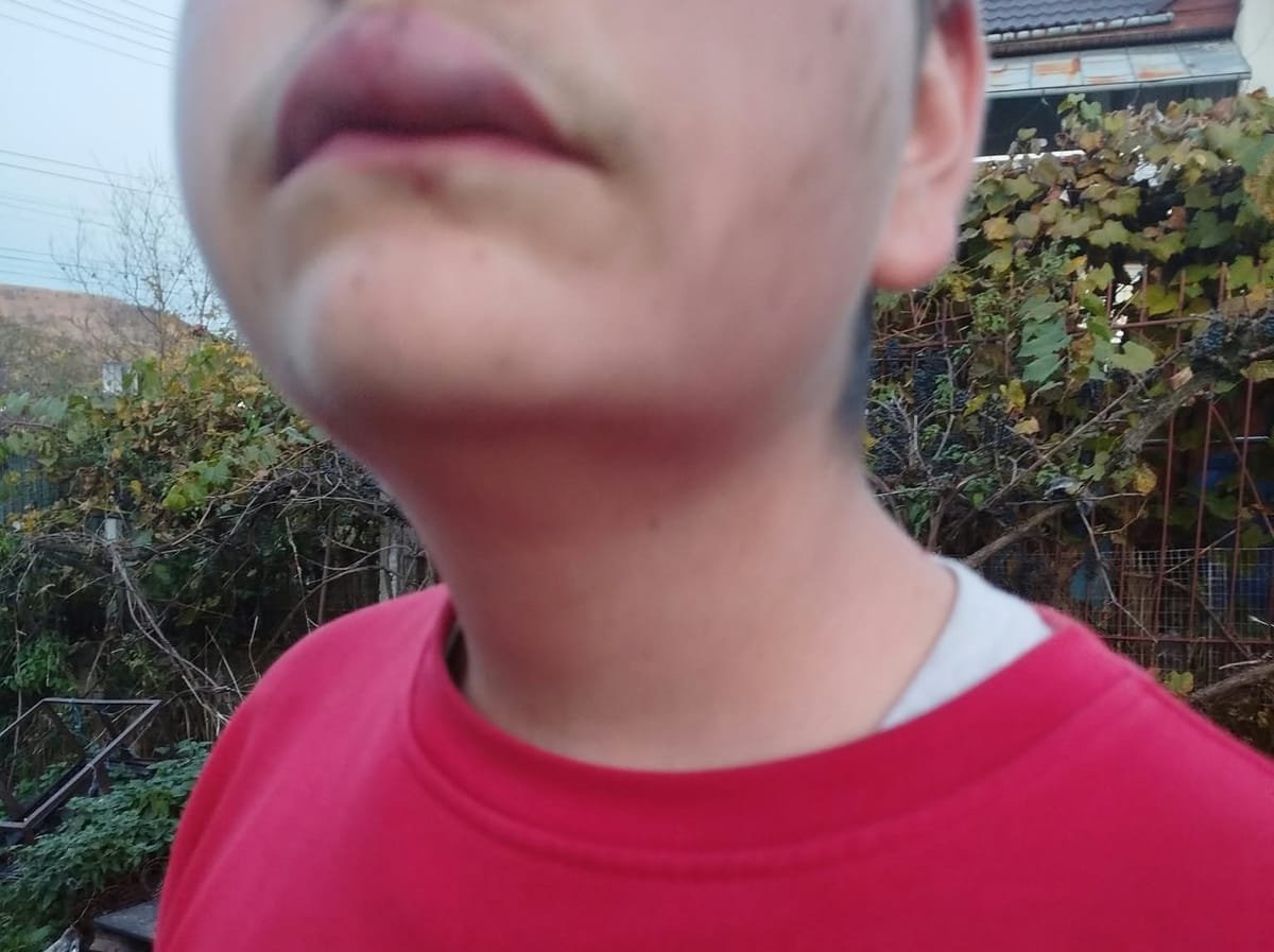 Mărișelu: băiat de 15 ani lovit și umilit de doi adolescenți, care au filmat scena; un agresor e reținut