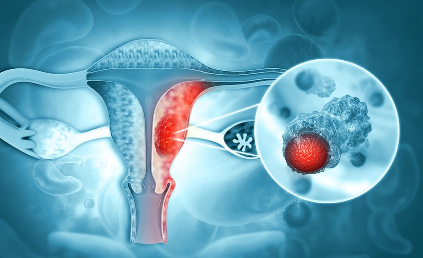 Târgu Mureș: screening de cancer de col uterin pentru femei din Regiunea Centru, prin proiectul CLARA